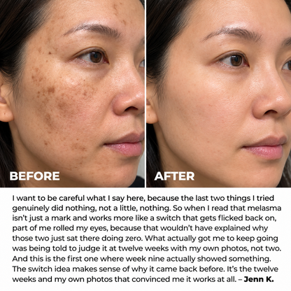 Revella's Cream for Melasma