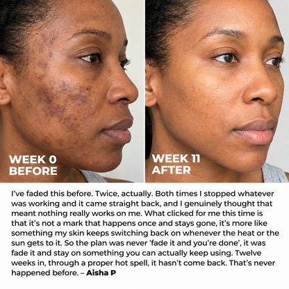 Revella's Cream for Melasma