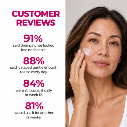 Revella's Cream for Melasma