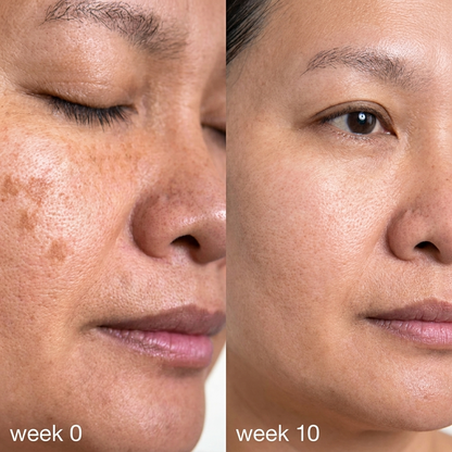 Revella's Cream for Melasma