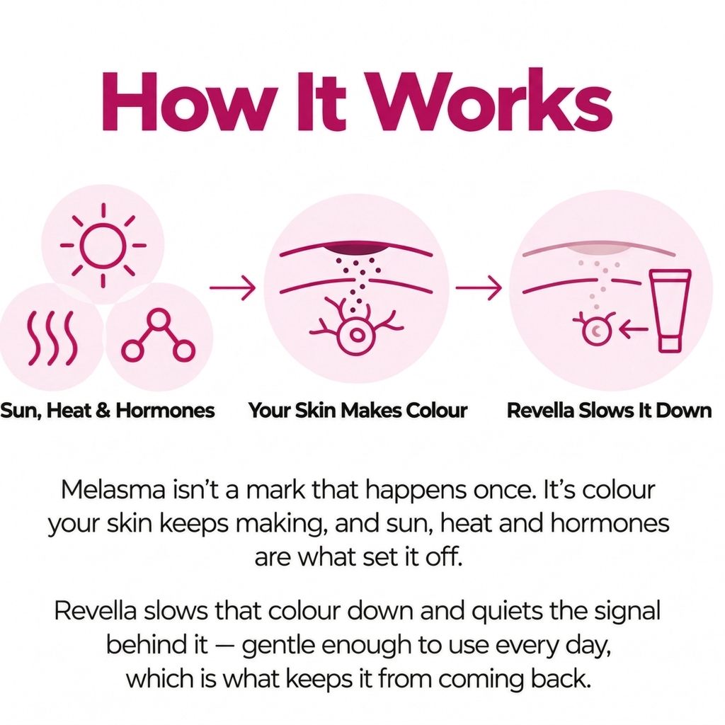 Revella's Cream for Melasma