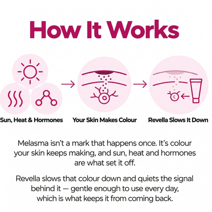 Revella's Cream for Melasma